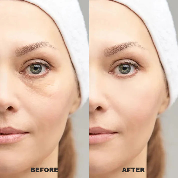 Under Eye Puffiness Remover