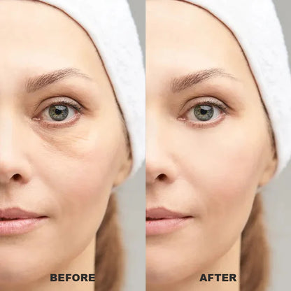 Under Eye Puffiness Remover
