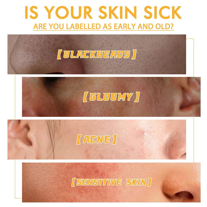 THE VIRAL EELHOE HONEY TEARING MASK